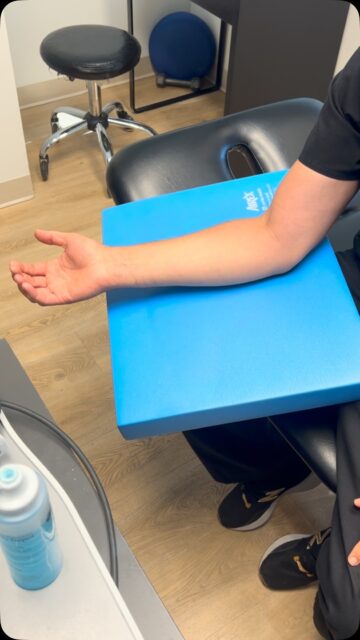 Inside elbow pain anybody? We assess our golfers elbow with selective tension testing and treat it with Acupuncture, Shockwave, eccentric exercise and the big kicker nerve entrapments up to the neck. Knowing where the tension is accumulating in the muscle and on the tendon that need to be worked out is very important. We clean up the tendinosis and the adhesions in the muscles tendons and nerves gives a healthy environment for strengthening and less tension and pain on those elbow. 
let’s get those elbows better.

Call us at 613-505-5000 or email us at PROACTIONsportsclinic@gmail.com. 

#elbowpain #Chiropractic #Physiotherapy #GolfersElbow #NerveEntrapment